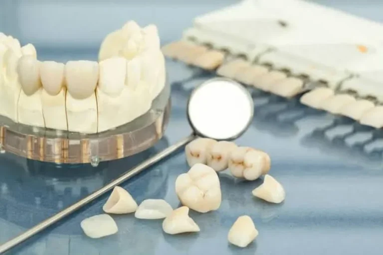 Dental Crown Treatment Process A Complete Step by Step Guide
